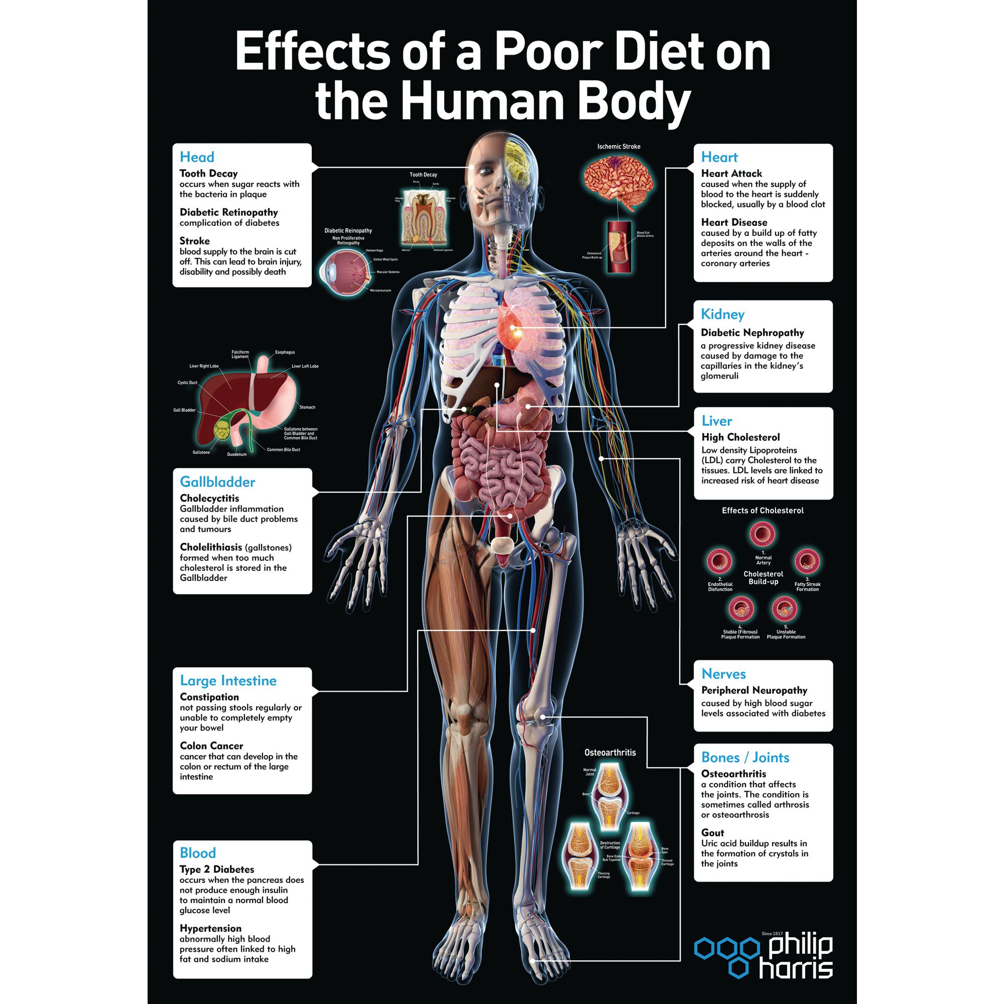 Effects Of Poor Nutrition